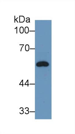 GC / Vitamin D-Binding Protein Antibody (aa209-394, APC)