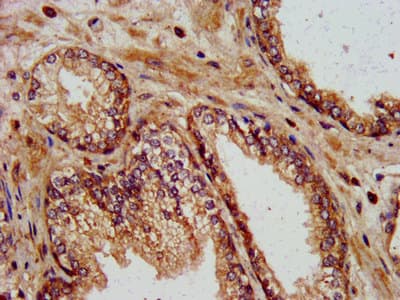 KIF13B / GAKIN Antibody