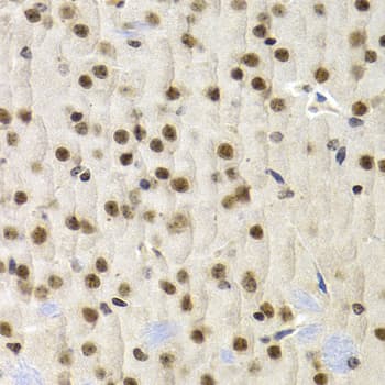 UMPS / OPRT Antibody
