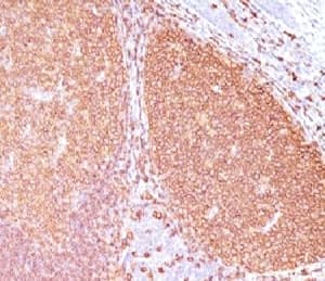 CD20 Antibody (clone IGEL/773, Ready-to-Use)