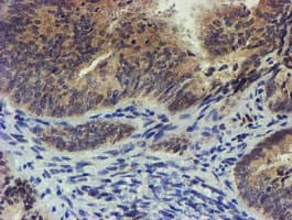 EEYORE / TIGD1 Antibody (aa1-267, clone OTI4G9)