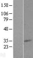 Human TM7SF2 Protein (Over-Expression Lysate Myc-DDK (Flag))