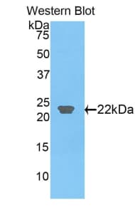 CLEC3B / Tetranectin Antibody (aa22-202)