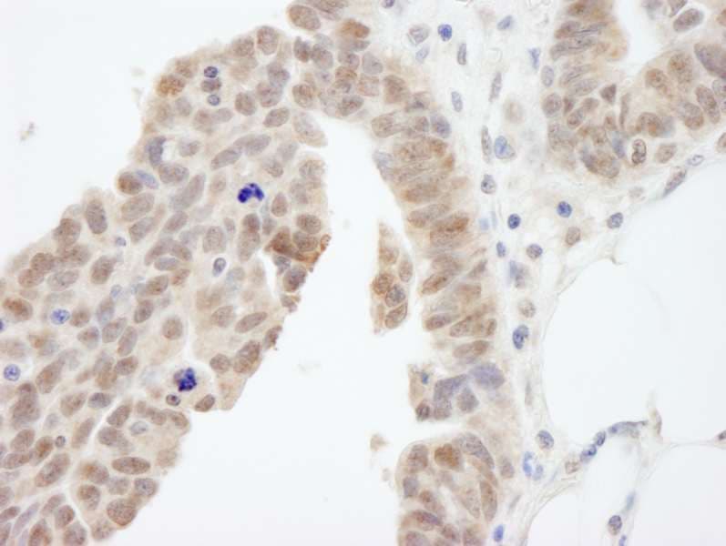 ABI1 / SSH3BP1 Antibody (aa325-375)