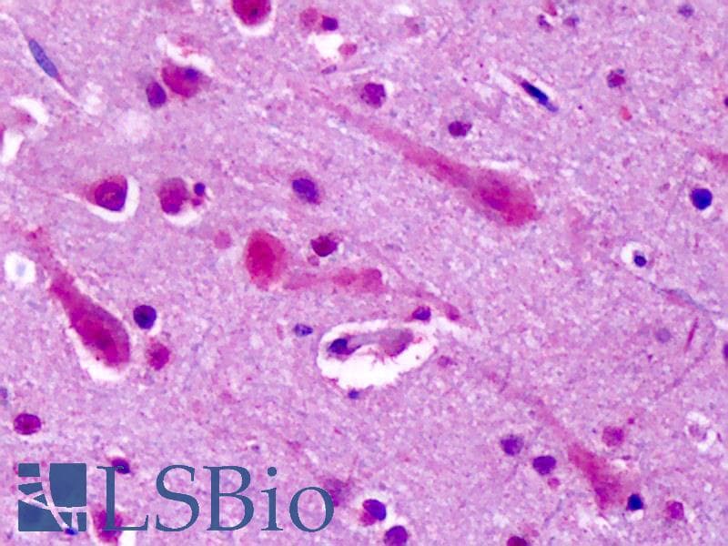 IHC-plus™ GRM7 / MGLUR7 Antibody (N-Terminus)
