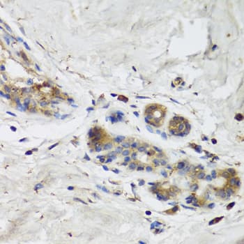 Polyclonal Rabbit anti-Human ISG15 Antibody (IHC, WB)