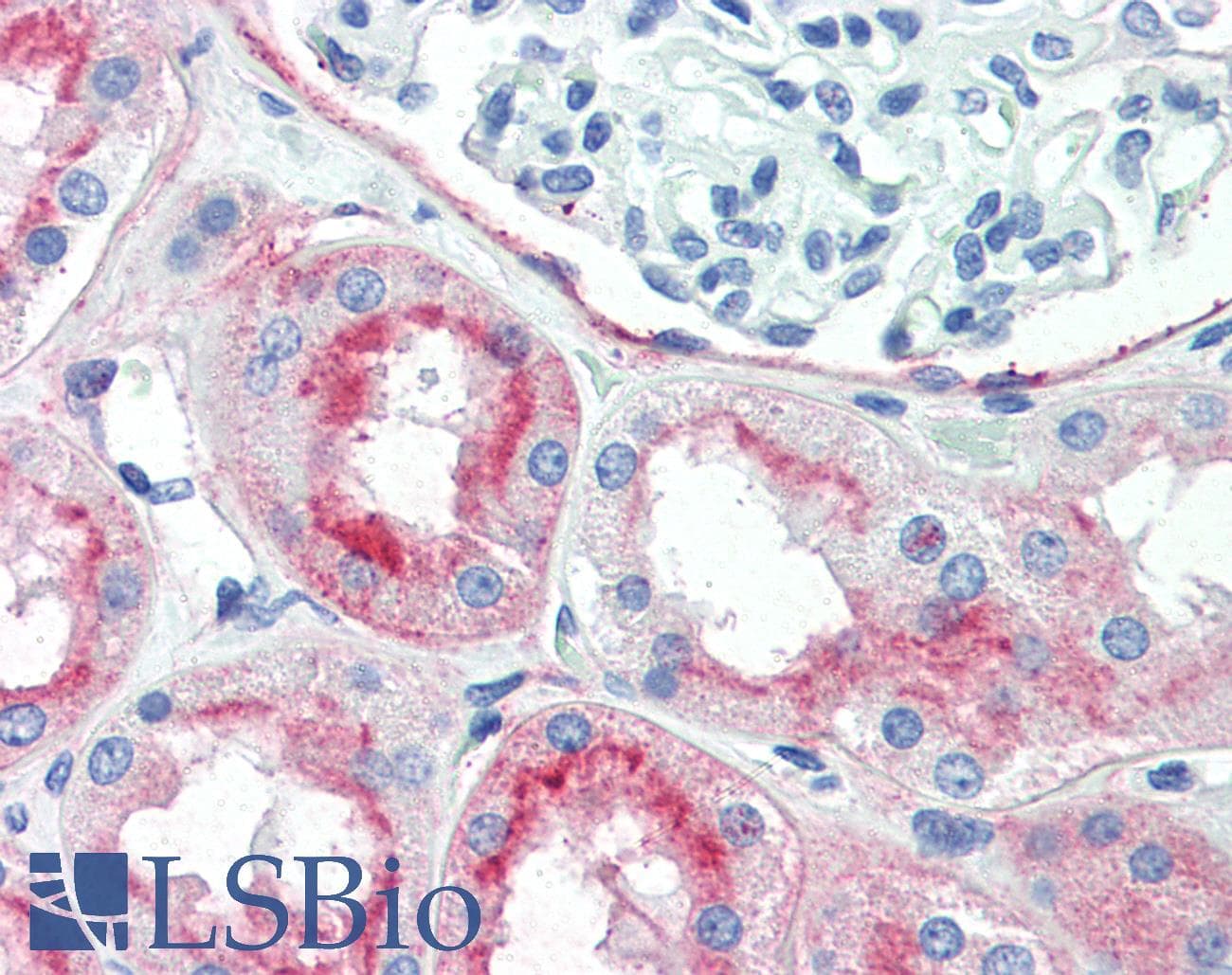 PathPlus™ Monoclonal Mouse anti-Human THY1 / CD90 Antibody (clone 5E10, IHC)