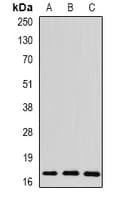 Polyclonal Rabbit anti-Human THRSP Antibody (IF, WB)