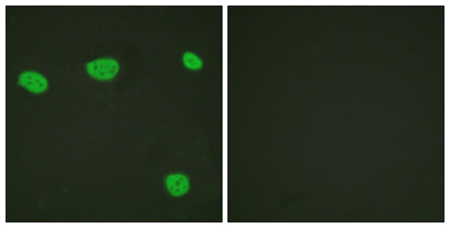 Vitamin D Receptor / VDR Antibody (p208)