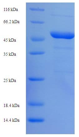 E. coli Outer Membrane Protein C (Recombinant His-SUMO)