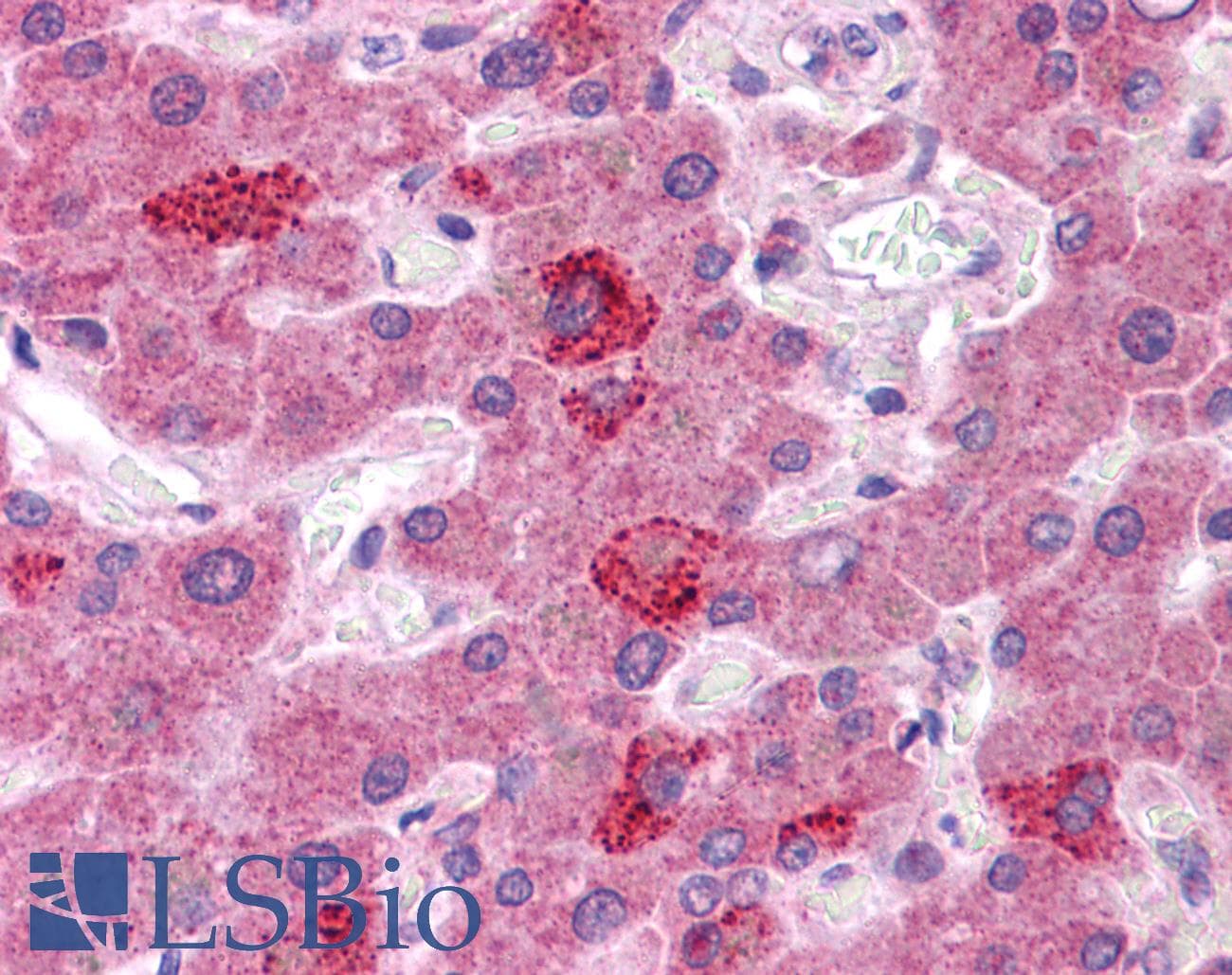 PathPlus™ HGF / Hepatocyte Growth Factor Antibody (aa216-265)