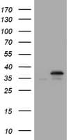 PCNA Antibody (clone OTI5B10)