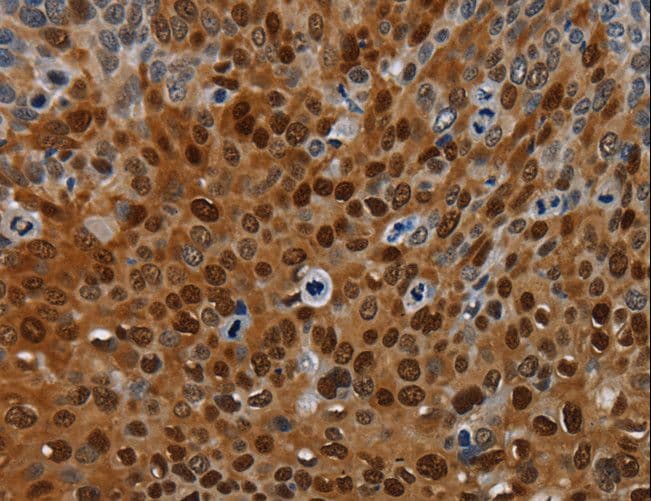 NRP2 / Neuropilin 2 Antibody