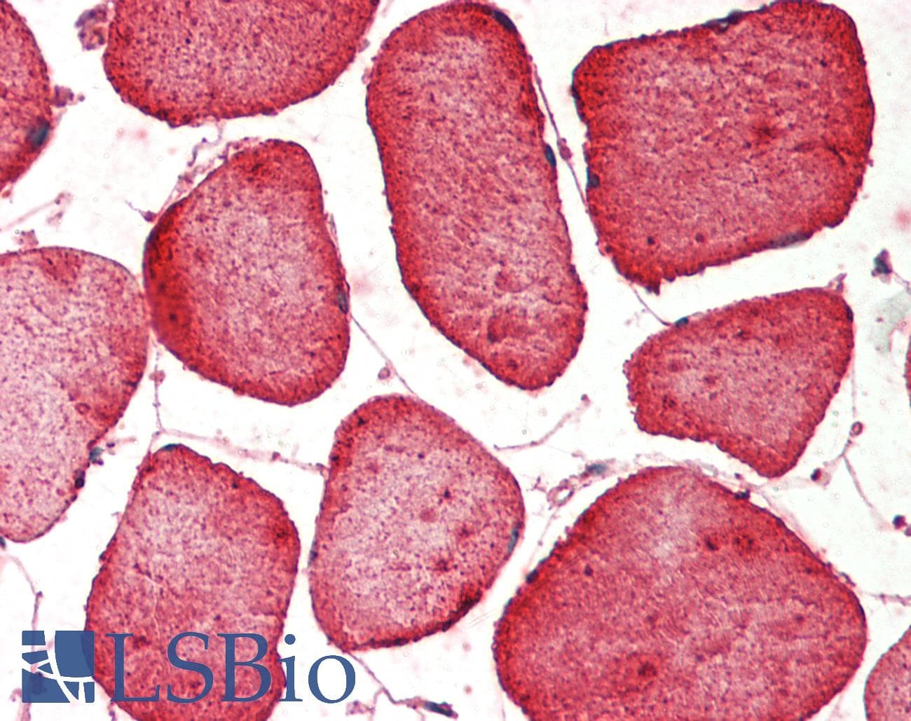 IHC-plus™ Hamartin / TSC1 Antibody (clone 357CT4.4.2)