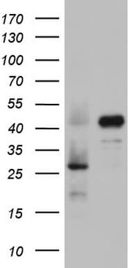 RBFOX1 / A2BP1 Antibody (aa1-210, clone OTI2C12)
