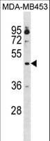 OPRK1 / Kappa Opioid Receptor Antibody (aa181-209)
