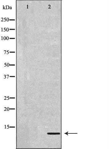 Polyclonal Rabbit anti-Human DEFB132 Antibody (IHC, WB)