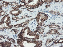FXYD3 Antibody (clone OTI1F12)
