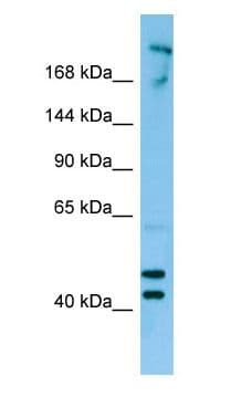 Polyclonal Rabbit anti-Human CDC42BPB / MRCKB Antibody (aa941-990, WB)