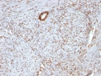 NCL / Nucleolin Antibody (aa364-365, clone 364-5 + NCL/902, Ready-to-Use)
