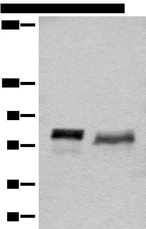 BCAS3 Antibody