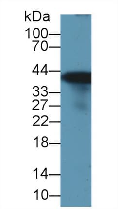 GLUL / Glutamine Synthetase Antibody (aa1-373)
