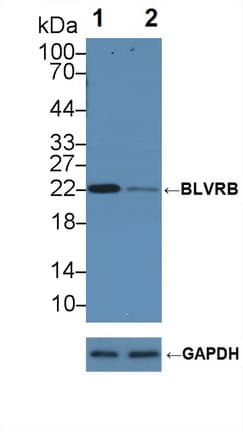 Polyclonal Rabbit anti-Human GHBP / BLVRB Antibody (aa2-206, WB)