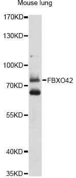 Polyclonal Rabbit anti-Human FBXO42 / JFK Antibody (WB)