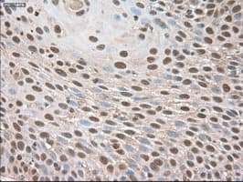 TRIM33 / TIF1-Gamma Antibody (clone OTI9D4)