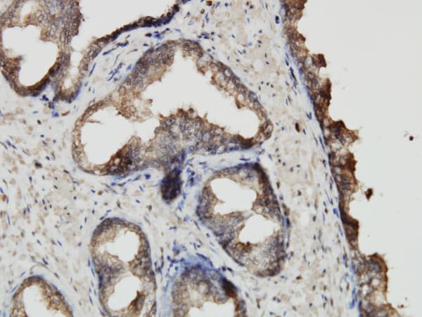 ABCF2 Antibody (clone 1D11)