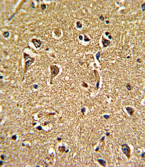 CACNG5 Antibody (aa192-220)