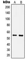 Polyclonal Rabbit anti-Human IPPK Antibody (N-Terminus, IHC, IF, WB)