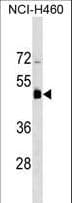 Polyclonal Rabbit anti-Human KRT36 / Keratin 36 / KRTHA6 Antibody (aa109-135, WB)