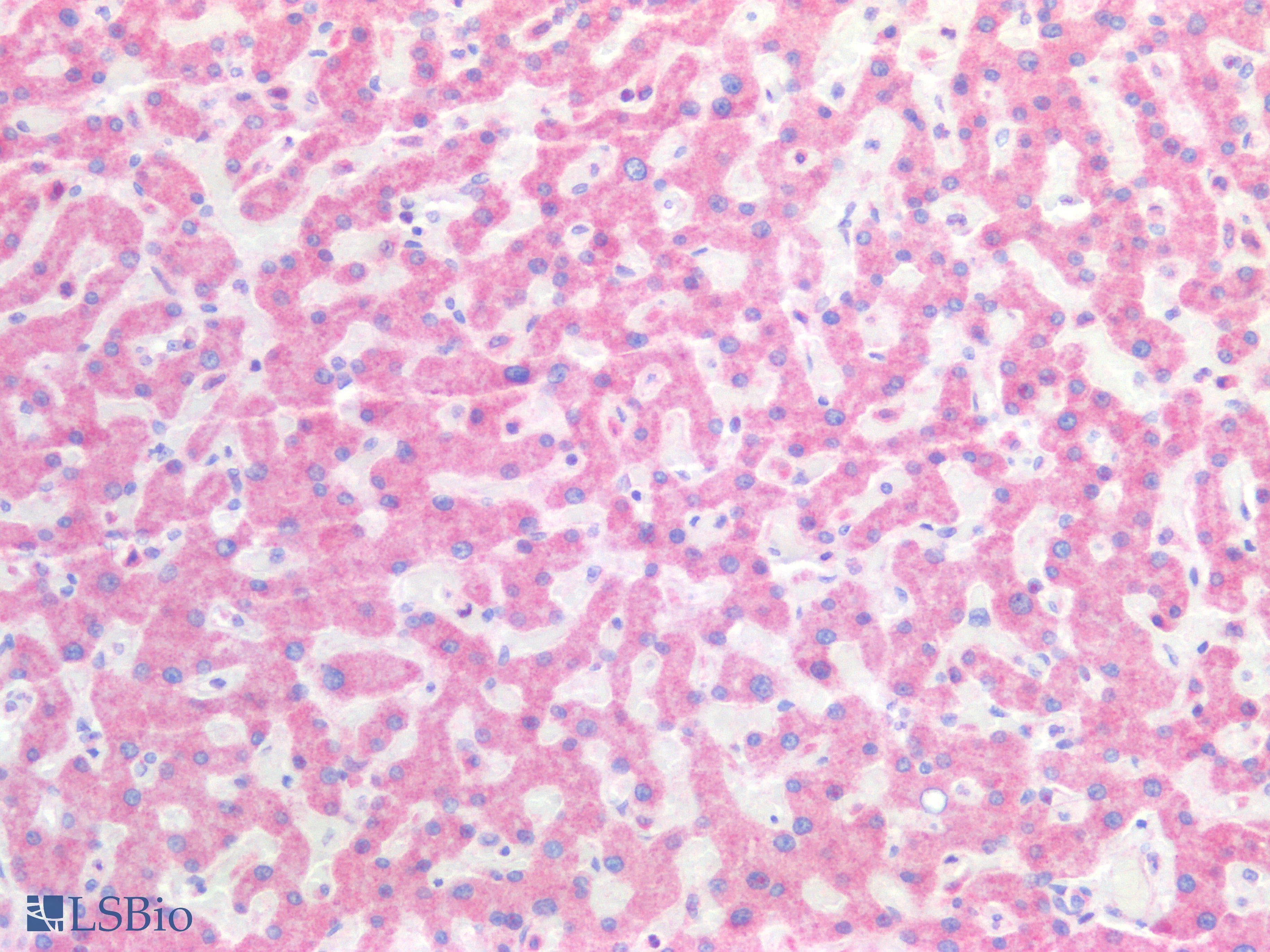 PathPlus™ HSD17B12 Antibody