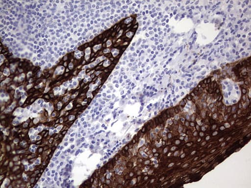 Monoclonal Mouse anti-Human KRT19 / CK19 / Cytokeratin 19 Antibody (clone OTI5H6, aa240-390, IHC, WB)