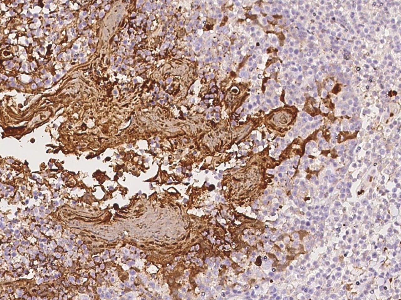 S100A8 / MRP8 Antibody