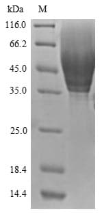 Human CD63 Protein (Recombinant 6His-SUMOstar, N-terminus)