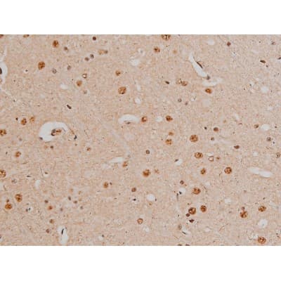 Polyclonal Rabbit anti-Human FLNA / Filamin A Antibody (phospho-Ser2152, IHC, IF, WB)