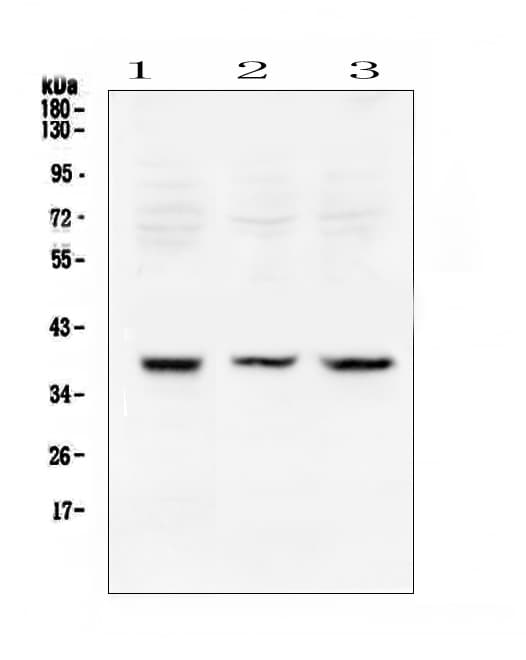 RAD51 / RECA Antibody