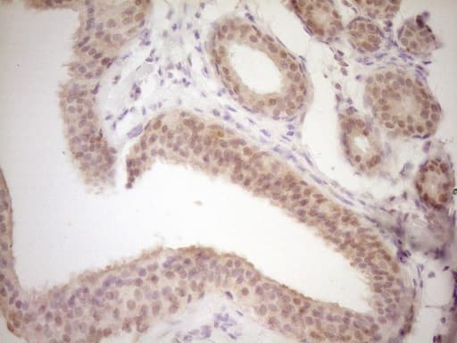 Monoclonal Mouse anti-Human TRB3 / TRIB3 Antibody (clone OTI3C6, aa1-200, IHC, WB)