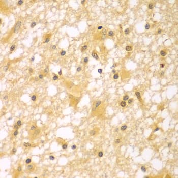 PAK6 Antibody