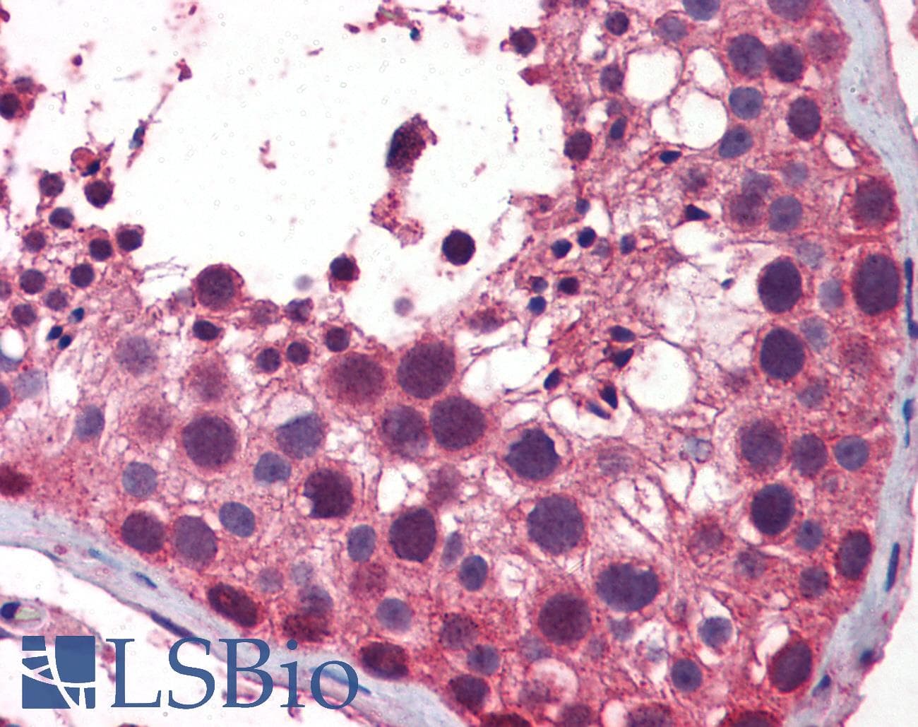 NAK / TBK1 Antibody (aa74-123)