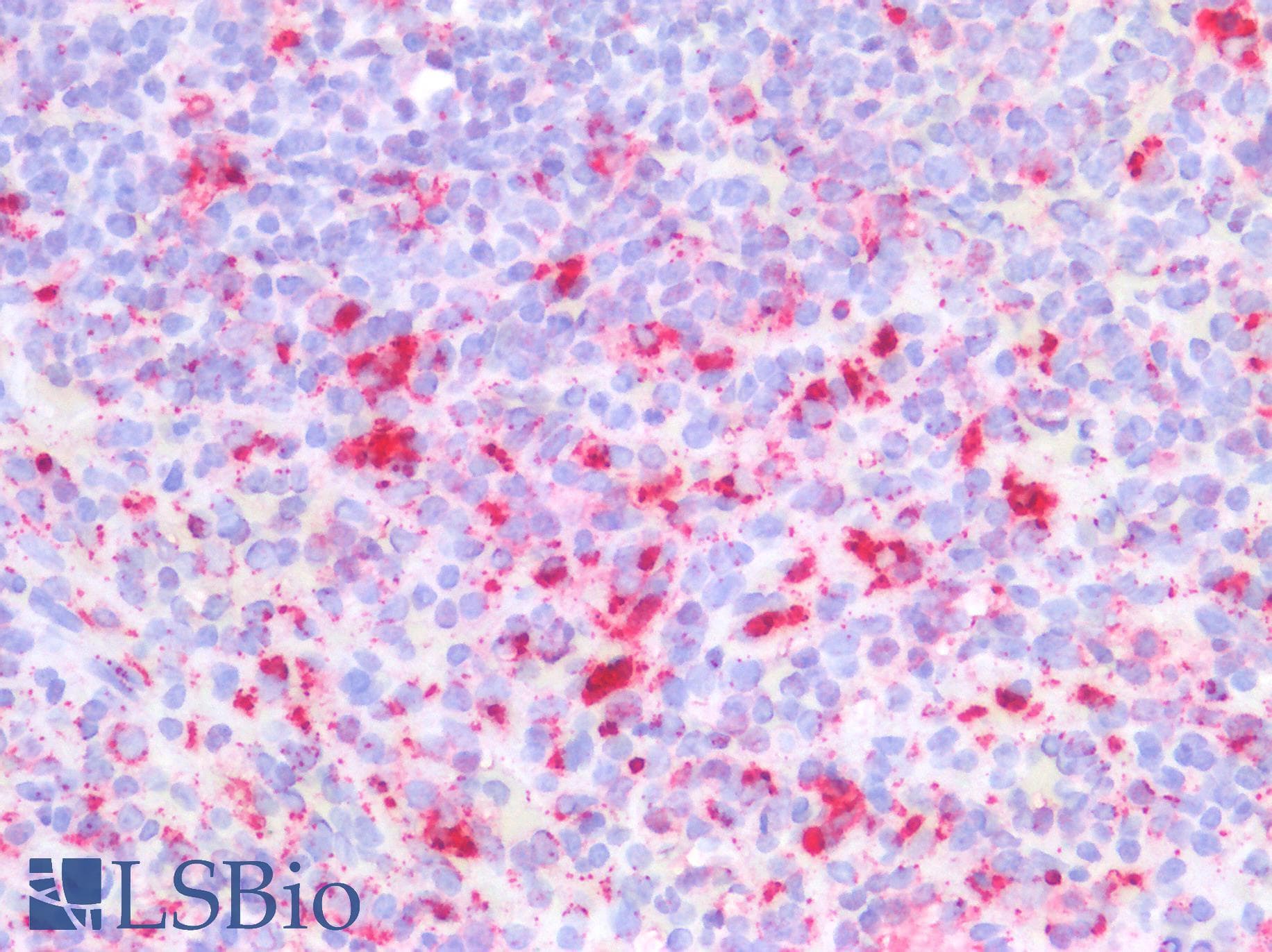 PSAP / Prosaposin Antibody (aa17-524)