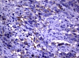 PIK3C2A Antibody (aa230-560, clone OTI2C11)