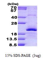 Human EDN2 / Endothelin 2 Protein (Recombinant His)