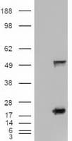 SHH / Sonic Hedgehog Antibody (clone OTI10H6)