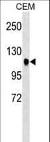 ATXN7 / SCA7 / Ataxin-7 Antibody (aa354-381)