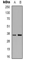 BABP / AKR1C2 Antibody (Internal)