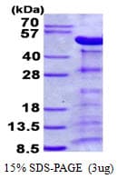 Human PARVA Protein (Recombinant His)