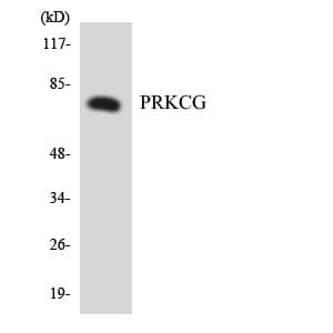 PRKCG / PKC-Gamma Antibody (aa603-652)